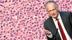 Finanzminister Marterbauer ist an einem Lymphom (Blutkrebs) erkrankt.