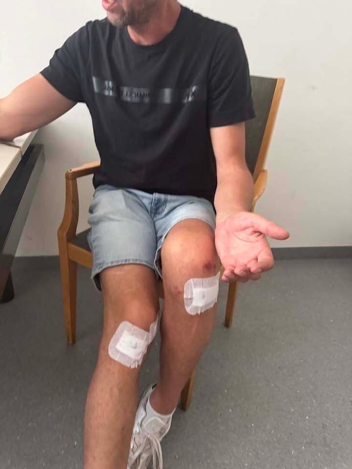The wounds from the attack are clearly visible on Josef H.