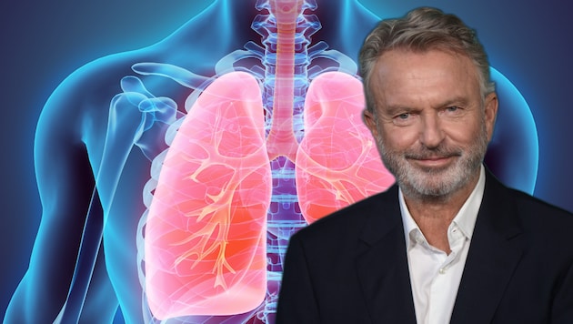 Hollywood-Star Sam Neill (78) ist an einer Lungenentzündung gestorben.