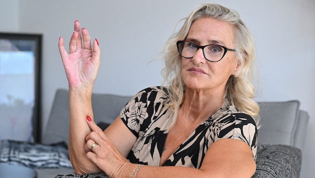 Manuela Marchner zeigt der „Krone“ ihre gut zehn Zentimeter lange Narbe – eine bleibende ...