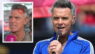 Das Netz rätselte über den weißen Krümel in seinem Mund – Robbie Williams kontert jetzt ganz ...
