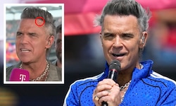 Das Netz rätselte über den weißen Krümel in seinem Mund – Robbie Williams kontert jetzt ganz ...
