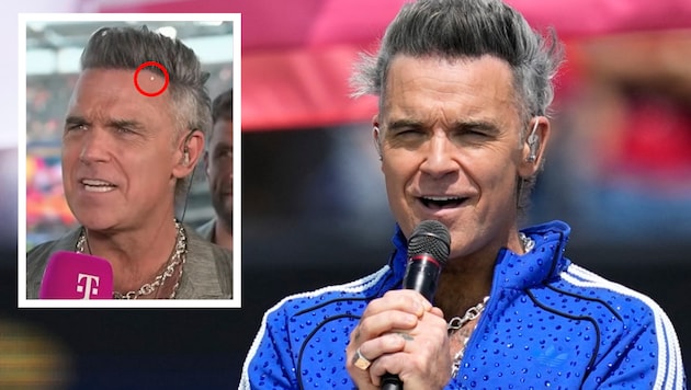 Das Netz rätselte über den weißen Krümel in seinem Mund – Robbie Williams kontert jetzt ganz ...