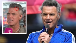 Das Netz rätselte über den weißen Krümel in seinem Mund – Robbie Williams kontert jetzt ganz ...
