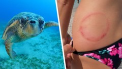 Mehrere Urlauber wurden von Schildkröten, mutmaßlich Unechten Karettschildkröten, angegriffen ...