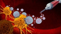 Die Krebsimpfung bringt speziell auf den Patienten und seinen Tumor abgestimmte Wirkmechanismen ...
