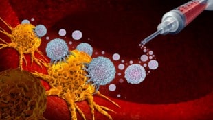 freshidea - stock.adobe.com Die Krebsimpfung bringt speziell auf den Patienten und seinen Tumor abgestimmte Wirkmechanismen ...