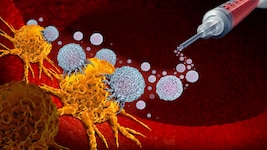 Die Krebsimpfung bringt speziell auf den Patienten und seinen Tumor abgestimmte Wirkmechanismen ...