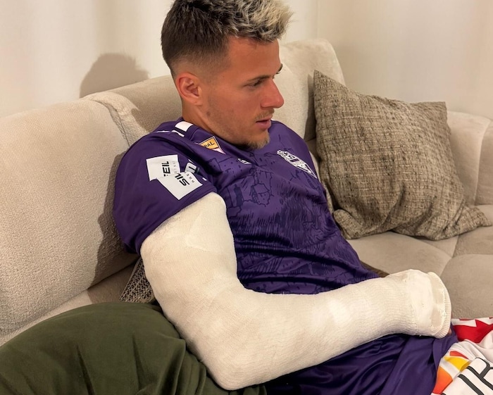 Ganzer Arm in Gips: Florian Rieder zog sich einen Speichenbruch zu.
