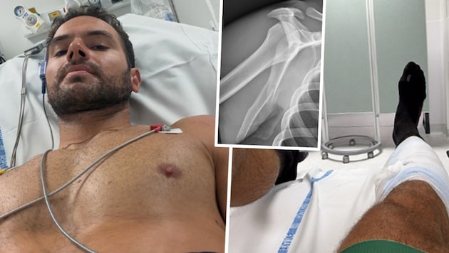 Ski-Weltmeister Mathieu Faivre lag im Krankenhaus.