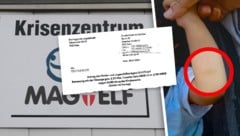Der blaue Fleck (Kreis) soll vom Spielen stammen. Die Mutter erhebt Vorwürfe gegen Kriseneltern ...