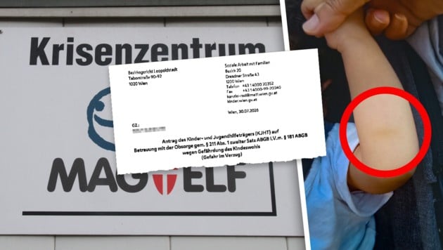 Der blaue Fleck (Kreis) soll vom Spielen stammen. Die Mutter erhebt Vorwürfe gegen Kriseneltern ...