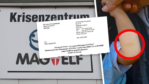 Der blaue Fleck (Kreis) soll vom Spielen stammen. Die Mutter erhebt Vorwürfe gegen Kriseneltern ...