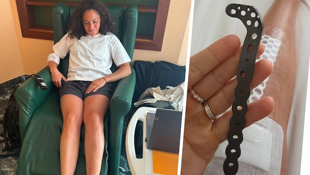 Ski-Superstar Federica Brignone gibt ihren Fans Einblicke in ihre Operation.