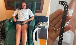 Ski-Superstar Federica Brignone gibt ihren Fans Einblicke in ihre Operation.