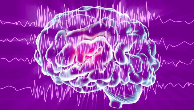 Die Epilepsie-Therapie ist heute klar patientenzentriert: Entscheidungen werden gemeinsam ...