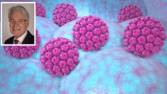 Gynäkologe Dr. Friedrich Gill informiert über die Risiken einer HPV-Infektion bei Männern.