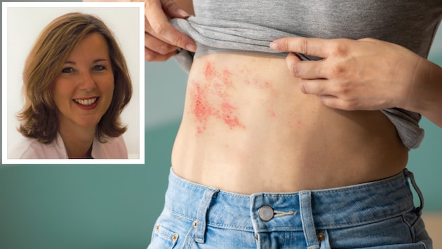 Dr. Claudia Heller-Vitouch erklärt, wie Gürtelrose entsteht und was man dagegen tun kann.