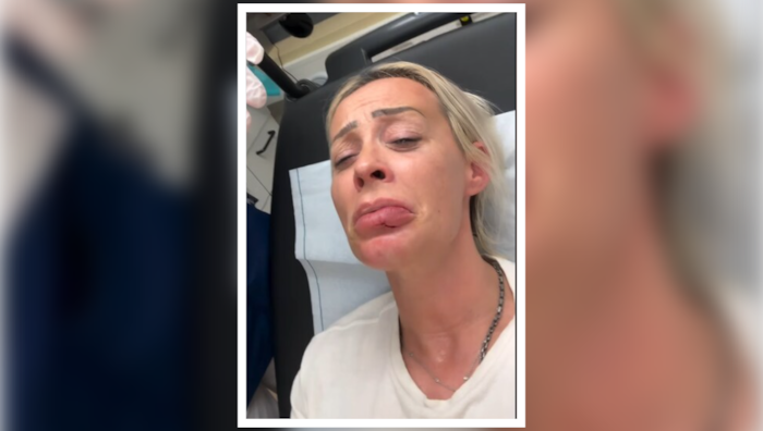 „Ich sehe echt aus wie Quasimodo!“ Schockmoment für alle Follower von Cora Schumacher. Die ...
