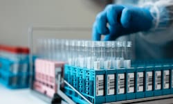 Anfang Oktober reagierten Gesundheitsbehörden in der russischen Region Irkutsk (Siberien) auf ...