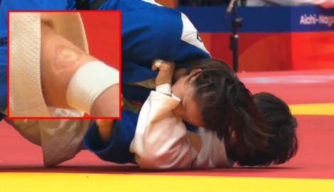 Die chinesische Judoka Tang Jing biss ihre japanische Gegnerin.