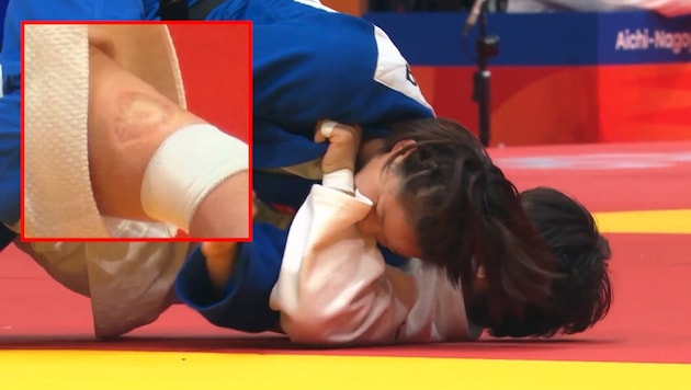 Die chinesische Judoka Tang Jing biss ihre japanische Gegnerin.