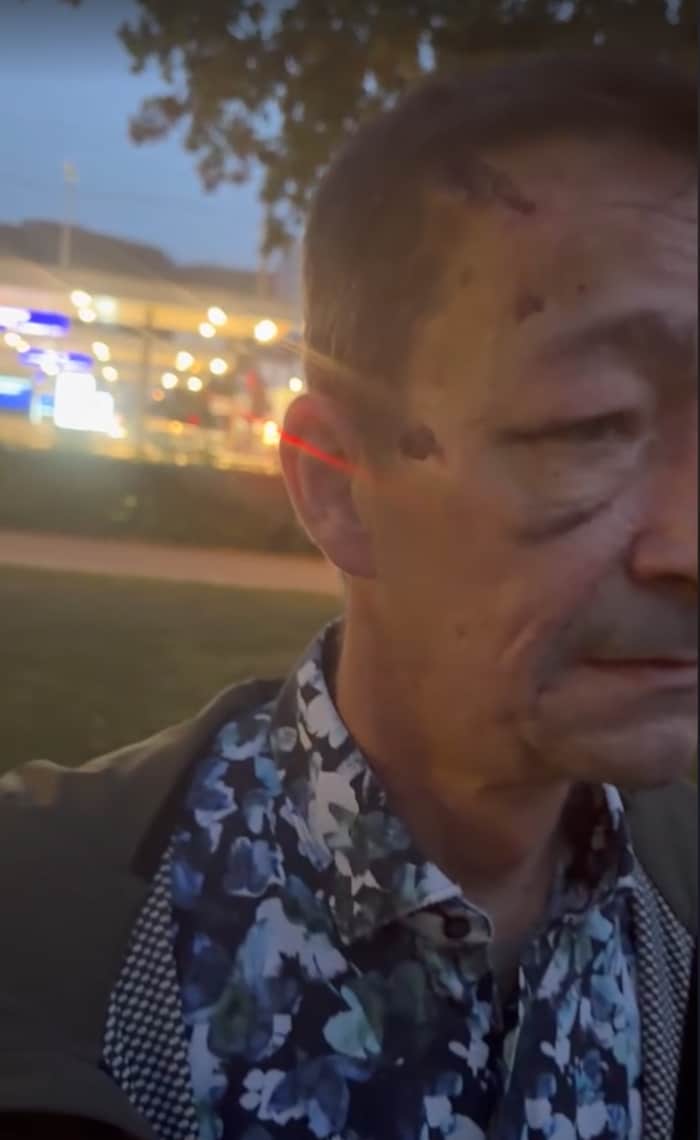 Ein blaues Auge, Abschürfungen am Kopf, eine gebrochene Rippe: Noch Tage später sind dem Opfer ...
