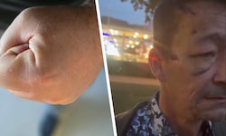 Klaus Schneider (Bild rechts) wurde mitten in Bregenz brutal überfallen.