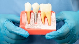 Bei Implantaten besteht noch Informationsbedarf.