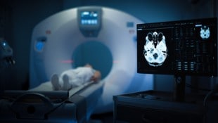 Immer mehr junge Erwachsene erhalten eine Krebsdiagnose. Forscher suchen nach den Ursachen des ...