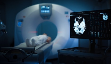 Immer mehr junge Erwachsene erhalten eine Krebsdiagnose. Forscher suchen nach den Ursachen des ...