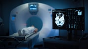 Immer mehr junge Erwachsene erhalten eine Krebsdiagnose. Forscher suchen nach den Ursachen des ...