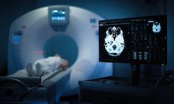 Immer mehr junge Erwachsene erhalten eine Krebsdiagnose. Forscher suchen nach den Ursachen des ...