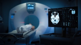 Immer mehr junge Erwachsene erhalten eine Krebsdiagnose. Forscher suchen nach den Ursachen des ...