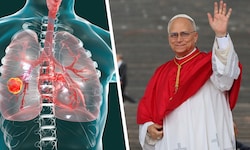 Lungenkrebs: Papst Leo wurde ein Teil der Lunge entfernt.