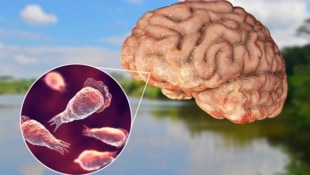 Laut Experten ernährt sich die Amöbe normalerweise von Bakterien. Sobald sie jedoch in Menschen ...