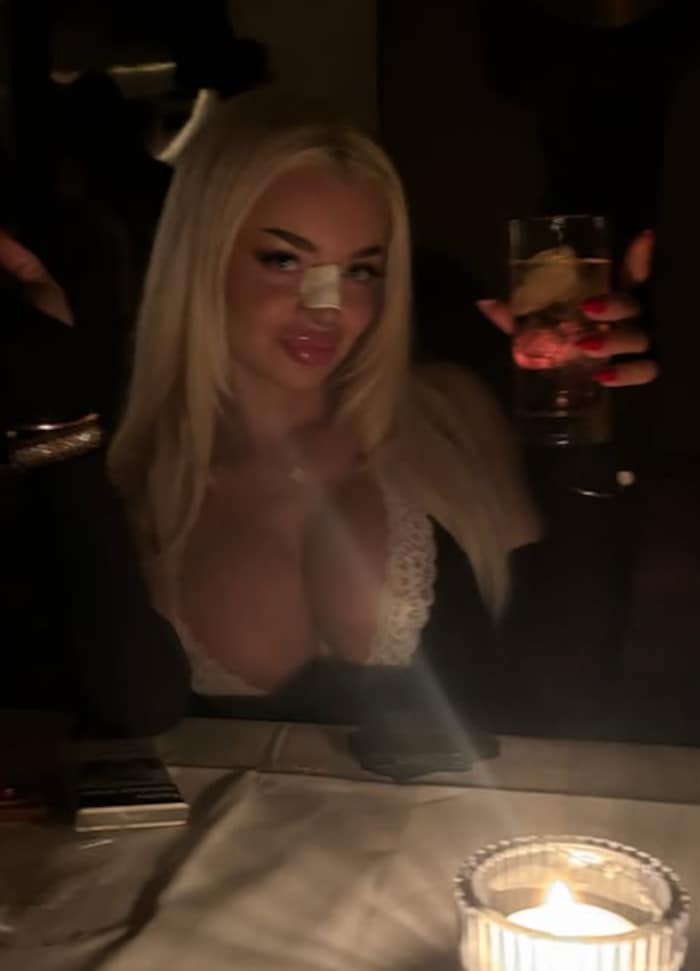 Kann schon wieder lächeln: Katja zeigt sich nach der überstandenen Operation auf Instagram in ...