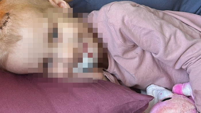 Leonie wurde im AKH schon mehrfach operiert.