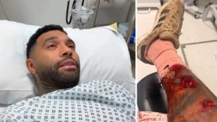 Jermaine Pennant im Krankenhaus – mit heftigen Bisswunden am Bein