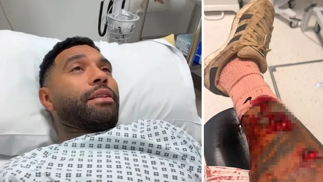 Jermaine Pennant im Krankenhaus – mit heftigen Bisswunden am Bein