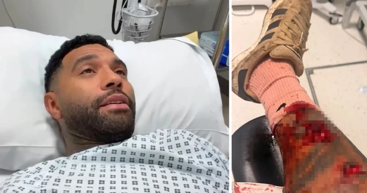 Véres támadás: kutyasétáltatás közben sebesült meg Jermaine Pennant volt liverpooli sztár