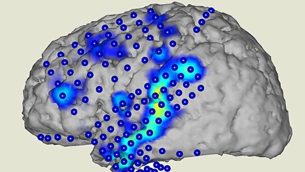 Gehirnaktivität beim Sprechen (Bild: CSL/KIT)