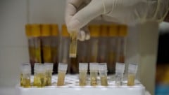 Laut einer Studie meidet etwa jeder dritte Mensch Informationen zu schweren Krankheiten, ...