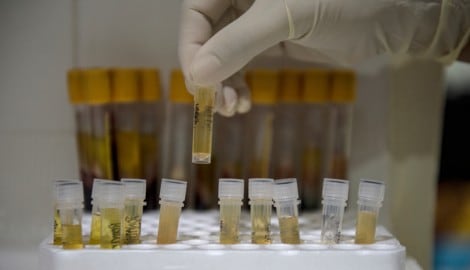 Die Aids-Hilfe bietet in Österreich kostenlose und anonyme HIV-Tests an (Symbolbild).