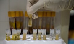 Laut einer Studie meidet etwa jeder dritte Mensch Informationen zu schweren Krankheiten, ...