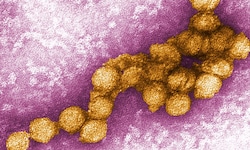 Digital eingefärbte elektronenmikroskopische Aufnahme des West-Nil-Virus