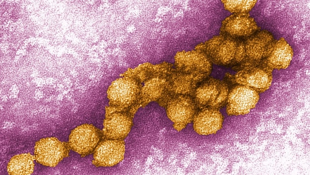 Digital eingefärbte elektronenmikroskopische Aufnahme des West-Nil-Virus