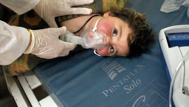 Eines der zahlreichen verletzten Kinder nach dem Giftgas-Angriff (Bild: AP)