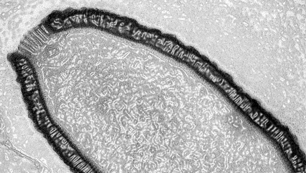 Ein aus sibirischem Permafrostboden isoliertes Riesenvirus namens Pithovirus sibericum (Bild: Julia Bartoli & Chantal Abergel, IGS und CNRS-AMU)