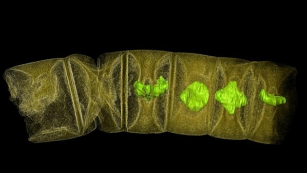 Auf dieser Röntgenaufnahme erscheint das in Indien gefundene Pflanzenfossil grün. (Bild: Stefan Bengtson)